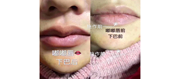 ㊣逆齡七大技術《美型技術》